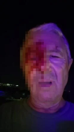 Haber yaparken saldırıya uğrayan muhabir yaralandı